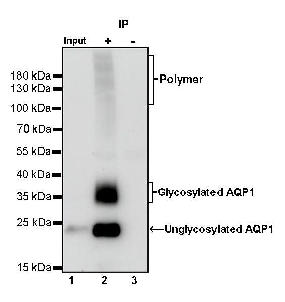 Aquaporin 1/AQP1 Recombinant Rabbit mAb (S-794-79)