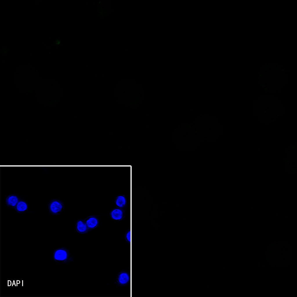 Lambda Light chain Recombinant Rabbit mAb (SDT-326-22)