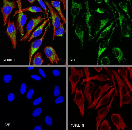 MFF Recombinant Rabbit mAb (S-2330-28)