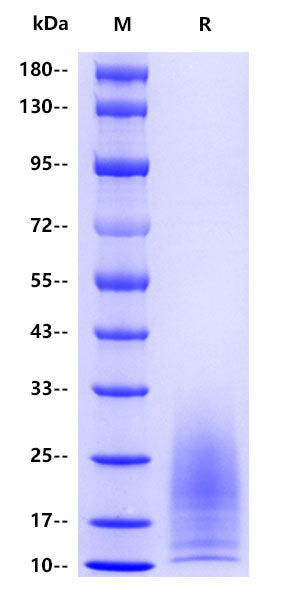Human NF-H(Neurofilament heavy polypeptide) , His tag
