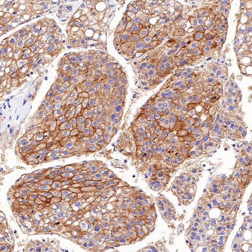 MDR1/ABCB1 Recombinant Rabbit mAb (SDT-872-21)