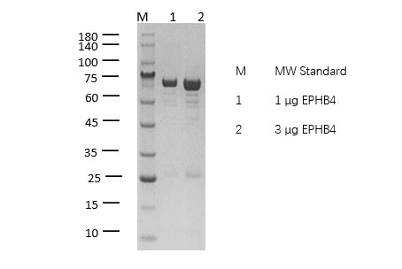EPHB4 Protein