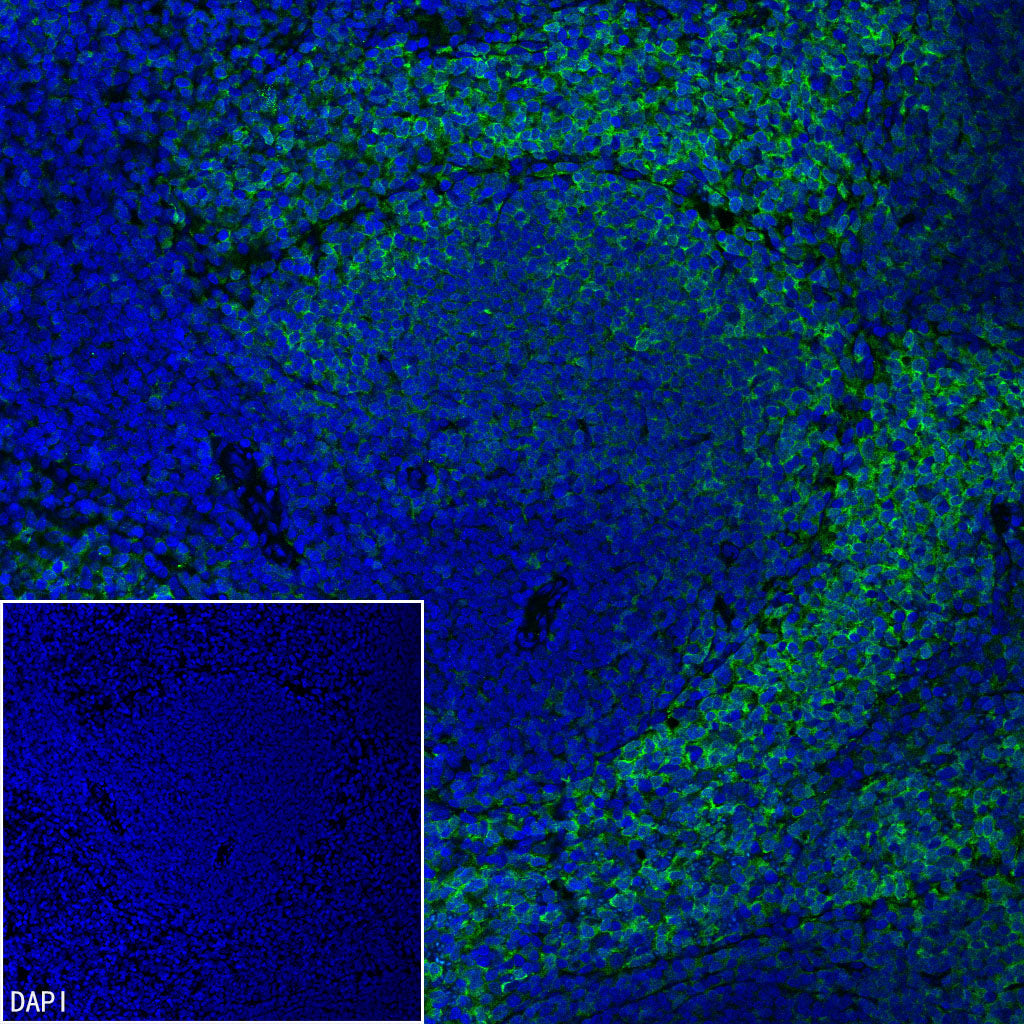 Syk Recombinant Rabbit mAb (S-4400-11)