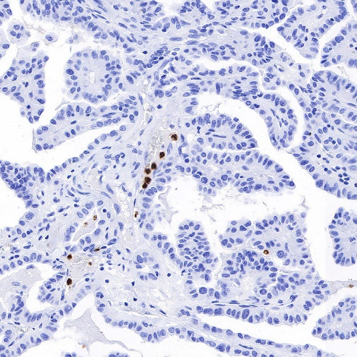 CD66b Recombinant Rabbit mAb (S-766-55)