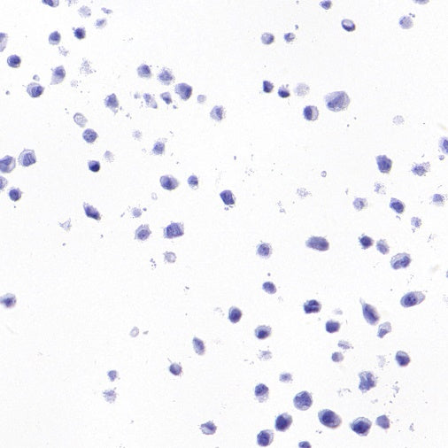 SEZ6 Recombinant Rabbit mAb (SDT-2097-7)