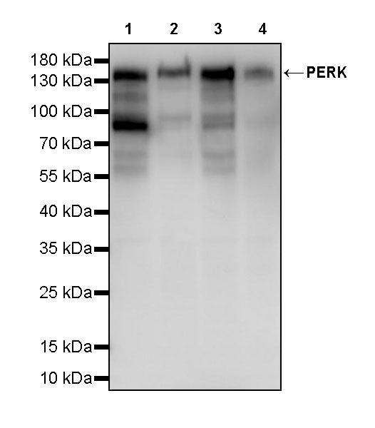 PERK Recombinant Rabbit mAb (S-4795)