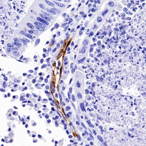 E-selectin Recombinant Rabbit mAb (S-1260-26)