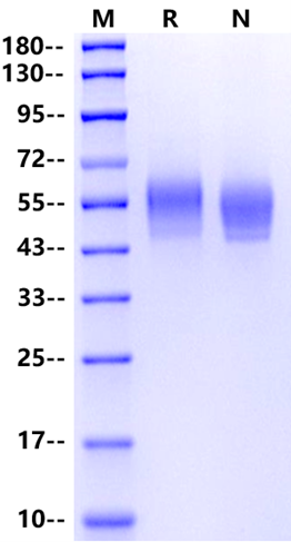 IL-3 Rα/CD123 His Tag Protein, Mouse