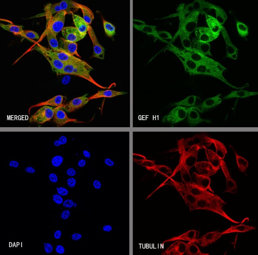 GEF H1 Recombinant Rabbit mAb (S-6057)