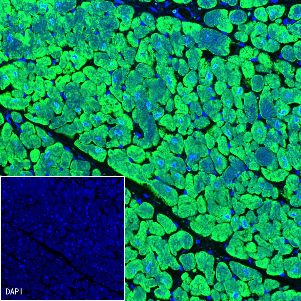 Alpha B Crystallin Recombinant Rabbit mAb (S-R216)