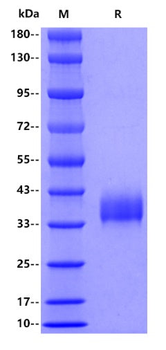 SARS-CoV-2 (JN.1/Omicron) RBD (V483), His tag