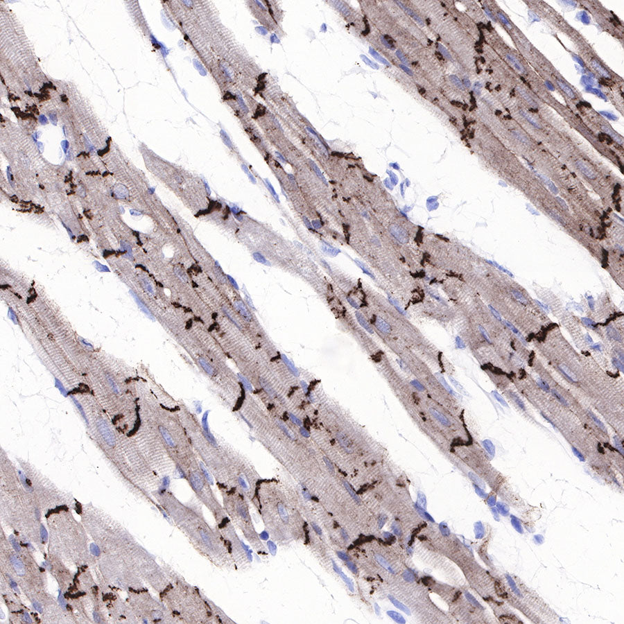 N-Cadherin Recombinant Rabbit mAb (SDT-329-12)
