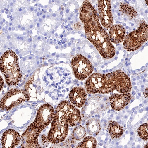 RBP4 Recombinant Rabbit mAb (S-693-111)