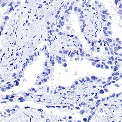 CK-13 Recombinant Rabbit mAb (SDT-R282)