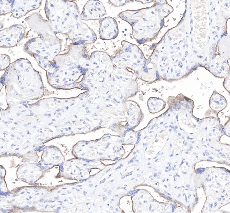 How Companion Diagnostic Antibodies Drive Breakthroughs in Precision Medicine
