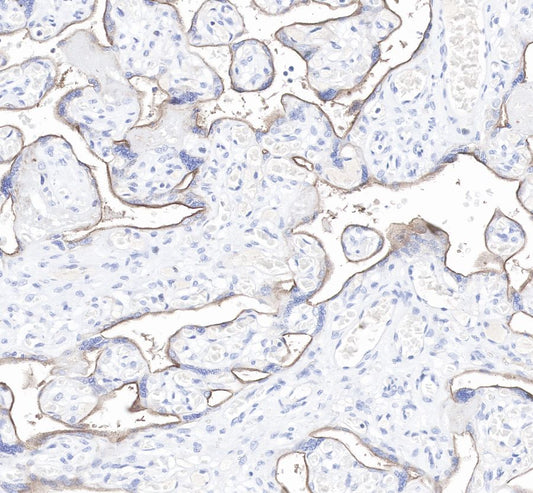 How Companion Diagnostic Antibodies Drive Breakthroughs in Precision Medicine
