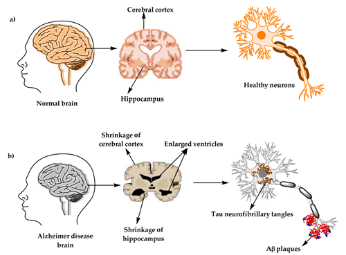 AD Model | Construction and Verification Solutions of Alzheimer's Disease Models