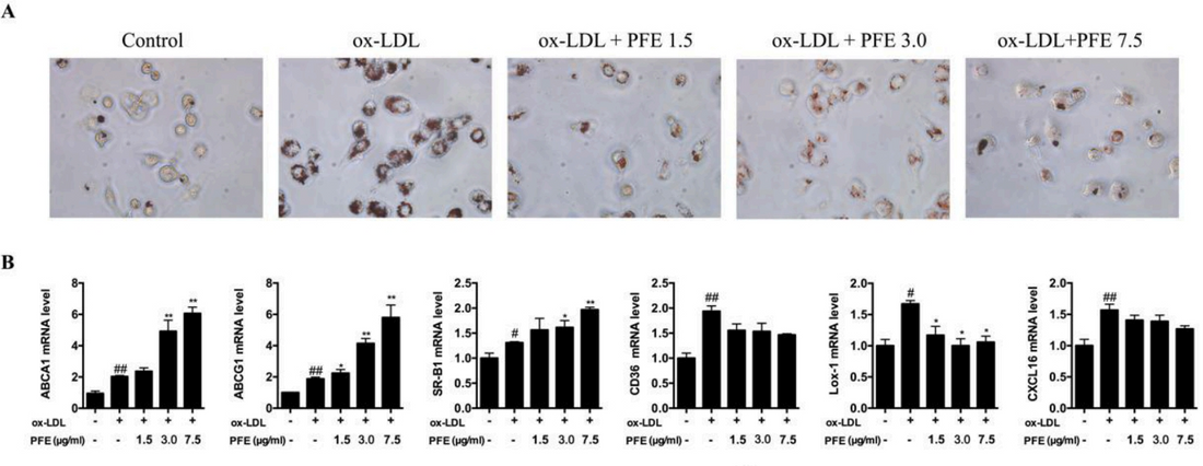 Three-Step Construction of Atherosclerotic Cell Models: A Comprehensive Guide to ox-LDL-Induced Injury, Foam Cell Formation, and Calcification