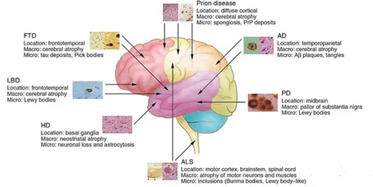 Tau Protein and Neurodegenerative Diseases: From Basic Research to Therapeutic Prospects  &nbsp;