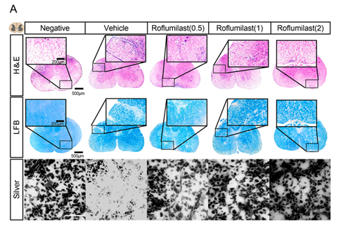 Roflumilast Modulates Neuroinflammation: Unlocking Therapeutic Potential for Motor Dysfunction and Depression in Multiple Sclerosis—Insights from EAE Model Research Supported by ANT BIO PTE. LTD.