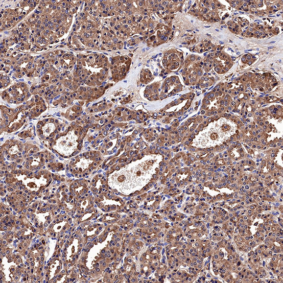 Development and Application of PSA Antibodies: A New Perspective in Prostate Cancer Diagnosis and Treatment