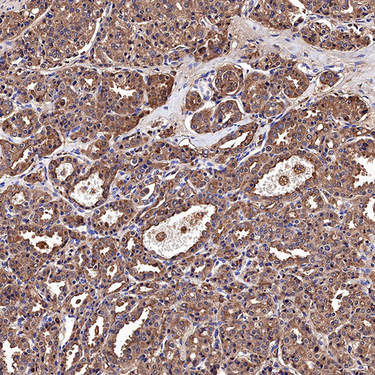 Development and Application of PSA Antibodies: A New Perspective in Prostate Cancer Diagnosis and Treatment