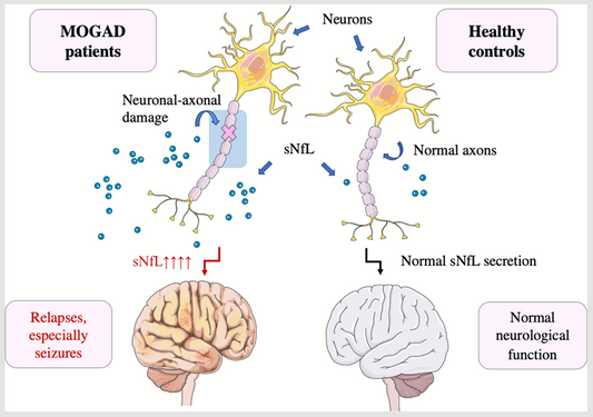 Neurofilament Light Chain (NfL): A Pivotal Biomarker for Neurological Injury and ANT BIO PTE. LTD.'s Solutions