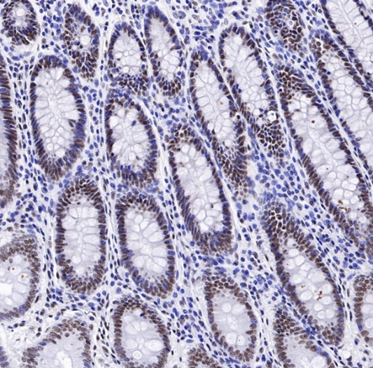 TDP-43: A Double-Edged Sword in ALS Pathogenesis and ANT BIO PTE. LTD.'s Antibody Solutions