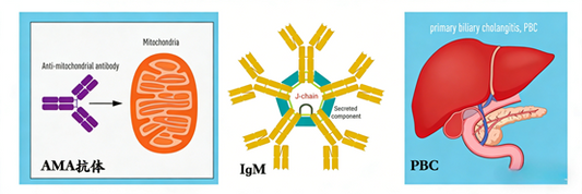 How can the Mouse IgM Surpass ELISA Kit contribute to the study of mechanisms and treatment of Primary Biliary Cholangitis (PBC)?