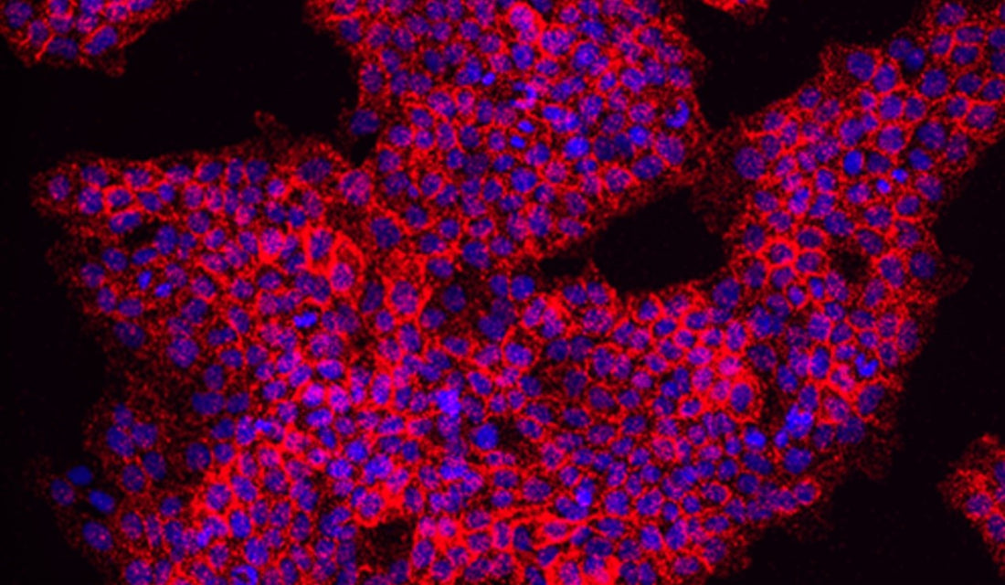 Proximity Ligation Assay (PLA) Meets PTMs: A Cutting-Edge Tool for Protein Research and ANT BIO PTE. LTD.'s Antibody Solutions
