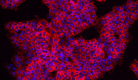 Proximity Ligation Assay (PLA) Meets PTMs: A Cutting-Edge Tool for Protein Research and ANT BIO PTE. LTD.'s Antibody Solutions