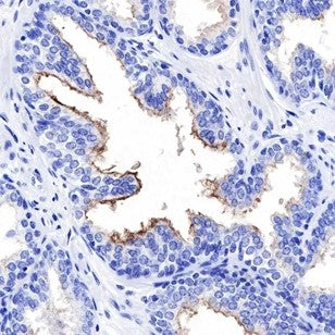 IHC Tumor Markers: Advanced Tools for Prostate Cancer Diagnosis and ANT BIO PTE. LTD.'s Antibody Solutions