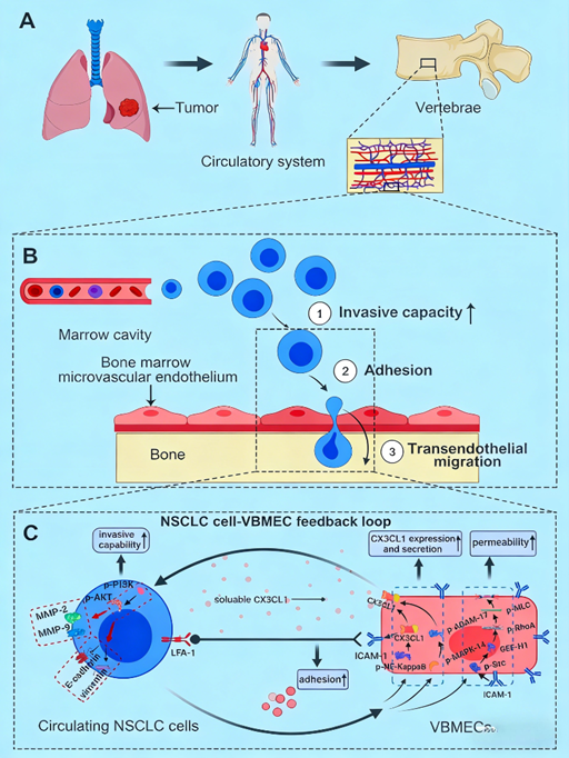 What regulatory mechanisms does VCAM-1 antibody reveal in the study of spinal metastasis?