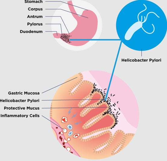 Unveiling the Critical Role of Human MICA Protein in Immune Regulation: Insights and Therapeutic Prospects