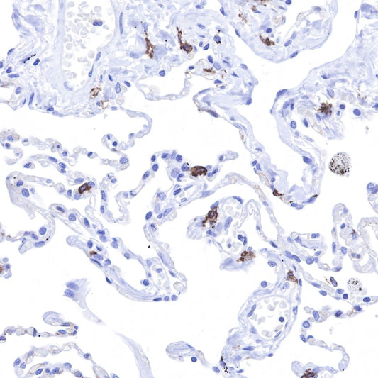 CD117 Antibodies in Immunohistochemical Detection: Applications and Quality Control Strategies by ANT BIO PTE. LTD.