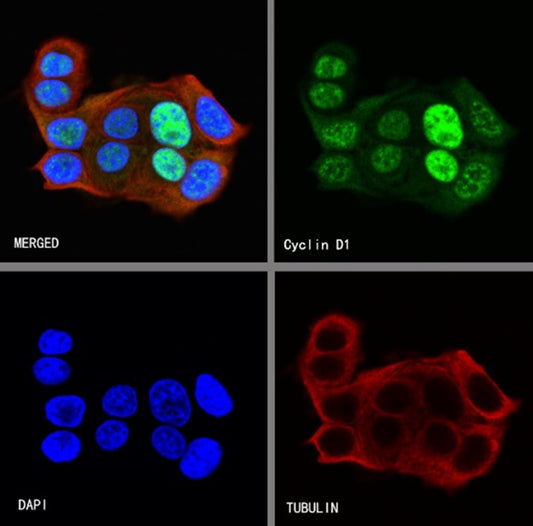 The Key Role of Cyclin D1 Antibodies in Tumor Pathological Diagnosis