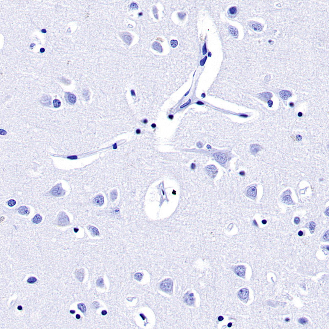 Prolactin/PRL Antibodies: Unraveling Sex-Specific Regulatory Mechanisms in Glioma Progression