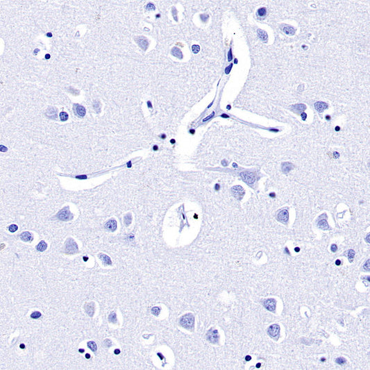 Prolactin/PRL Antibodies: Unraveling Sex-Specific Regulatory Mechanisms in Glioma Progression