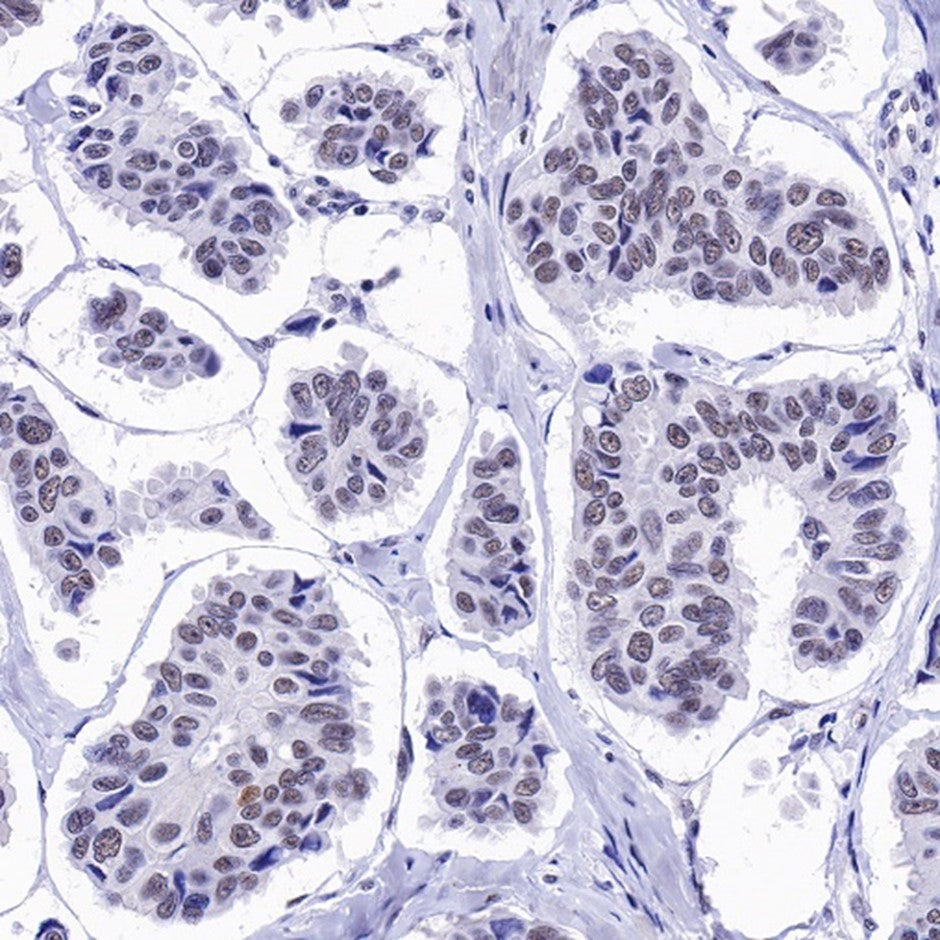 How Does the U2AF2 Recombinant Rabbit Monoclonal Antibody Elucidate the Splicing Pathogenic Mechanisms in Neurodevelopmental Disorders?