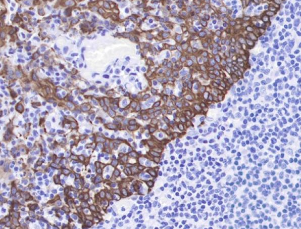 How to Achieve Efficient Optimization of Antibody Affinity?