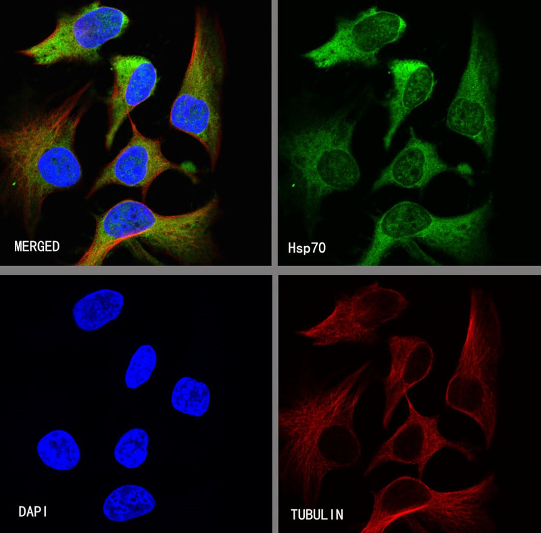 Immune Checkpoint Antibodies &amp; Loading Control Antibodies: Dual Pillars for Reliable Tumor Immunology Research and Western Blot Validation