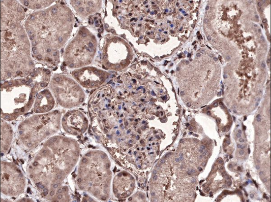 Pan-Modified Microspheres: Enabling Rapid, High-Efficiency Antibody Conjugation with ANT BIO PTE. LTD.