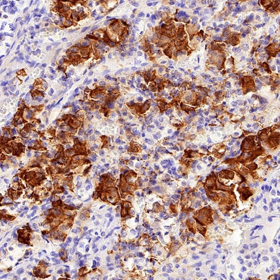 Prolactin Antibodies: Core Tools for Endocrine Disease Diagnosis and Research