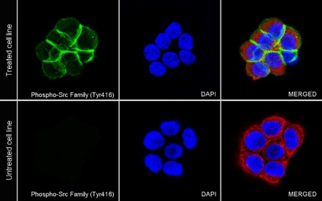 Electrostatic Interactions in T Cell Receptor Signaling: Regulating Initiation and Immune Specificity