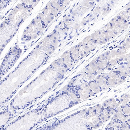 Antibody Customization Technical Support: The Cornerstone of Successful Antibody Development | ANT BIO PTE. LTD
