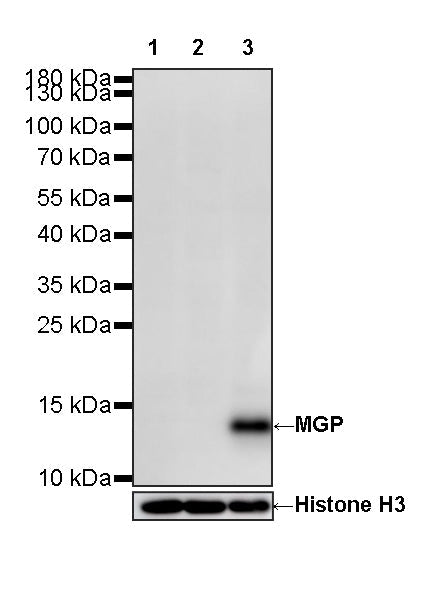 MGP Antibody Validation: Matrix Gla Protein Detection in Calcified Tissue Research