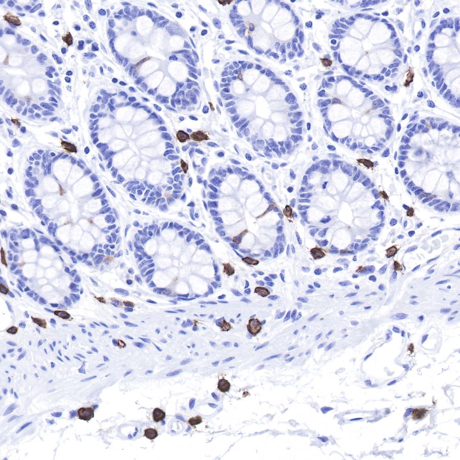 CD Molecules: The Immune Cell Identity Map and Advanced Tools for Immunophenotyping