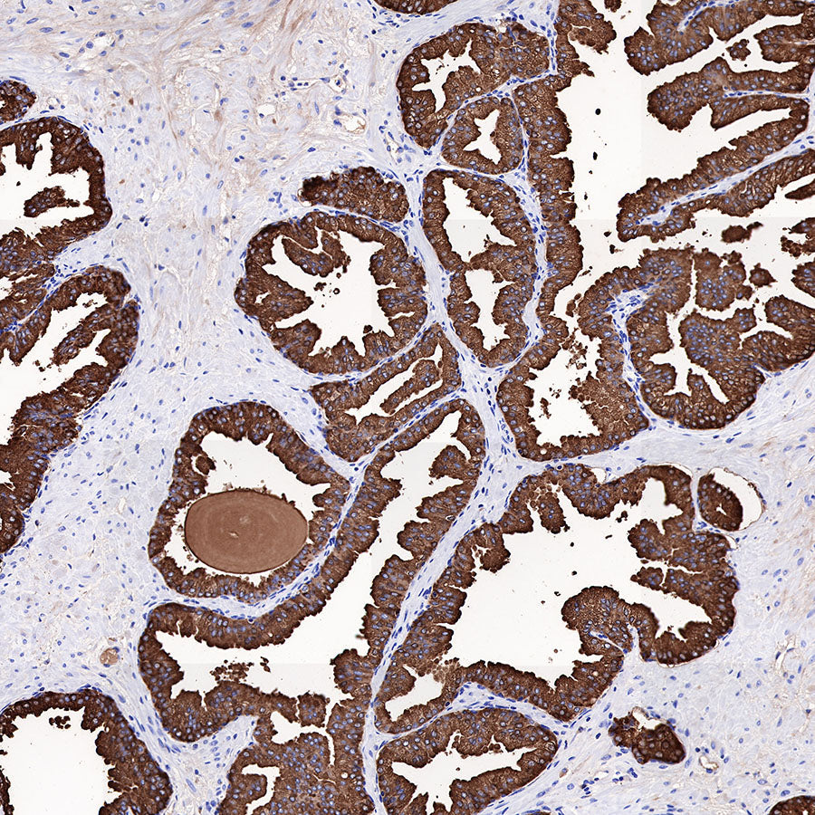 Knowledge Insight: How PSA Recombinant Rabbit Monoclonal Antibodies Improve Precision in Prostate Cancer Diagnosis and Treatment