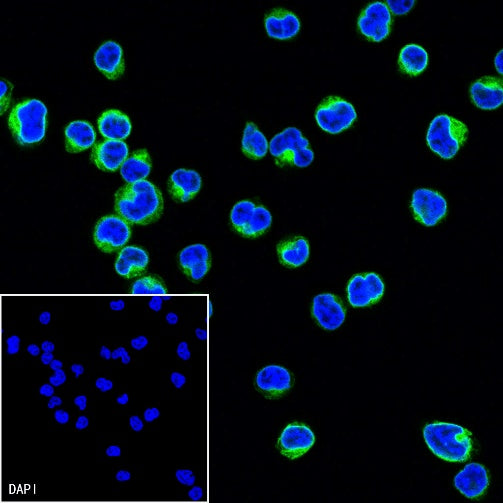 How Tumor Marker Antibodies Empower Precision Cancer Diagnosis