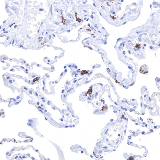 Applications and Quality Control Strategies of CD117 Antibody in Immunohistochemical Detection